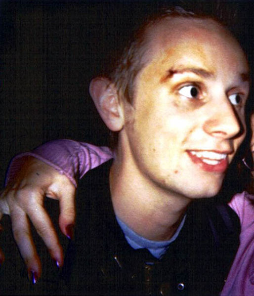 File:Dominic Howard injured.jpg